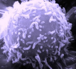lymphocyte © public domain.