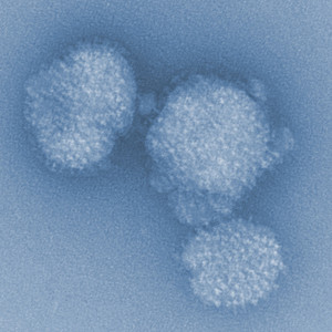 Influenza virus, magnified by electron microscopy. © HZI / Rohde